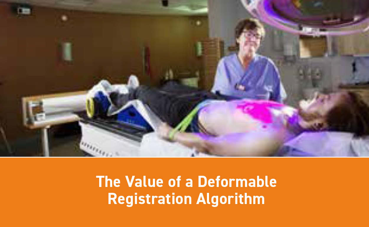 For medical physicists considering surface-guided radiation therapy… here’s a thought on the value of a deformable registration algorithm