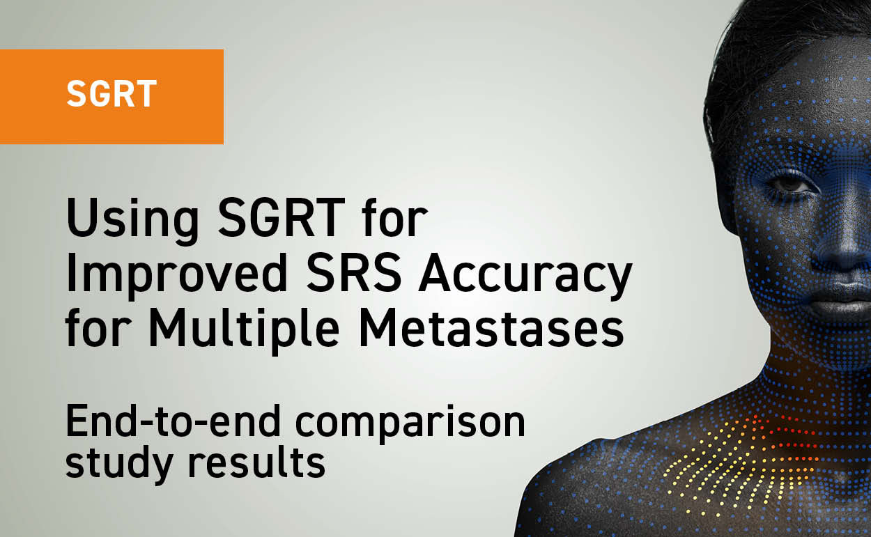 Using SGRT for Improved SRS Accuracy